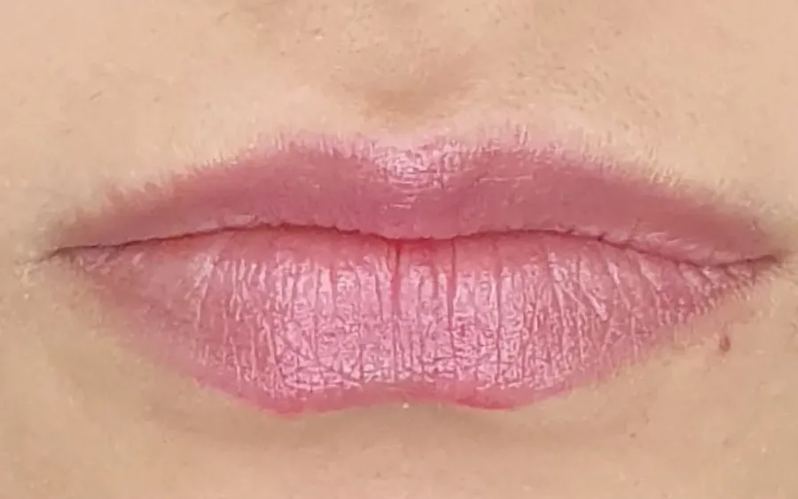 Antes do preenchimento labial, caso 2 — paciente da biomédica Jessica Boza em Curitiba